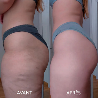 Huile Anti-Cellulite